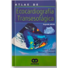 Ecocardiografía Transesofágica