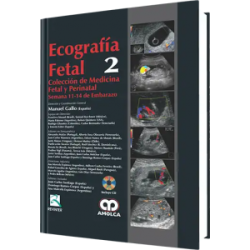 Ecografía Fetal No. 2.