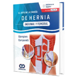 El Arte de Hernia Inguinal y Femoral