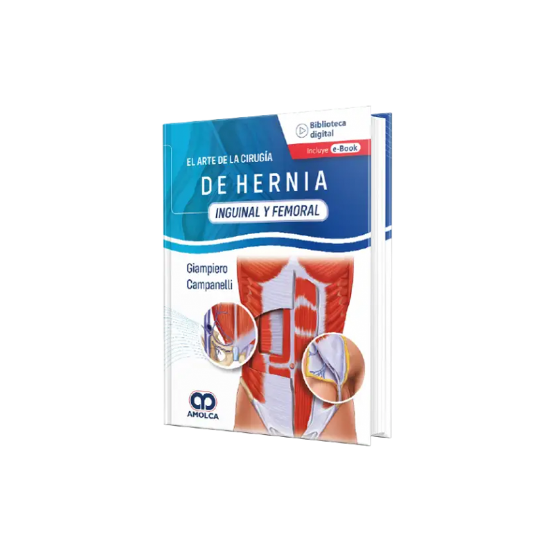 El Arte de Hernia Inguinal y Femoral