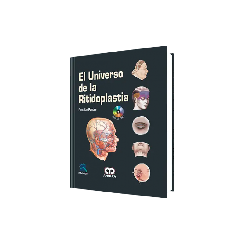 El Universo de la Ritidoplastia. Incluye DVD