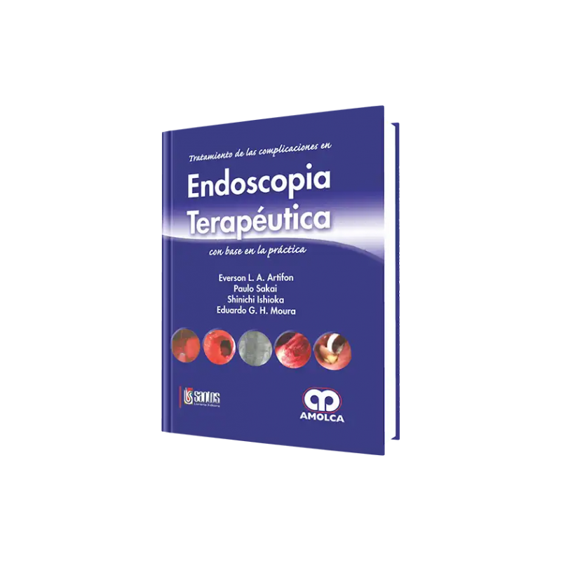 Endoscopia Terapéutica