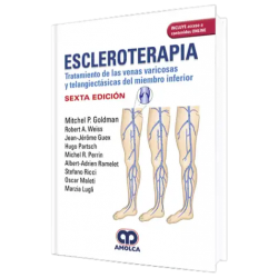 Escleroterapia. Tratamiento de las Venas Varicosas y Telangiectásicas del Mienbro Inferior