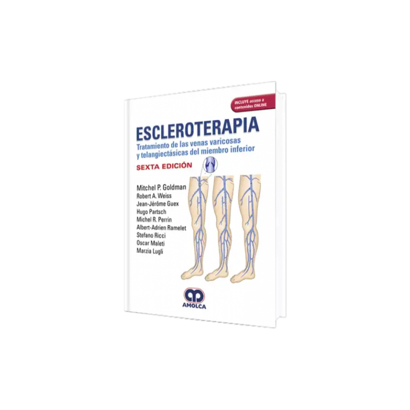 Escleroterapia. Tratamiento de las Venas Varicosas y Telangiectásicas del Mienbro Inferior