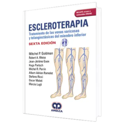 Escleroterapia. Tratamiento de las Venas Varicosas y Telangiectásicas del Mienbro Inferior