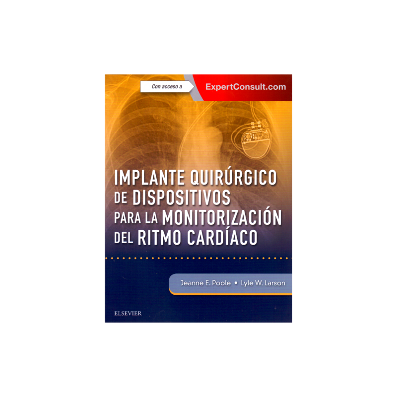 Poole: Implante quirúrgico de dispositivos para la monitorización del ritmo cardíaco + ExpertConsult © 2018 9788491133148