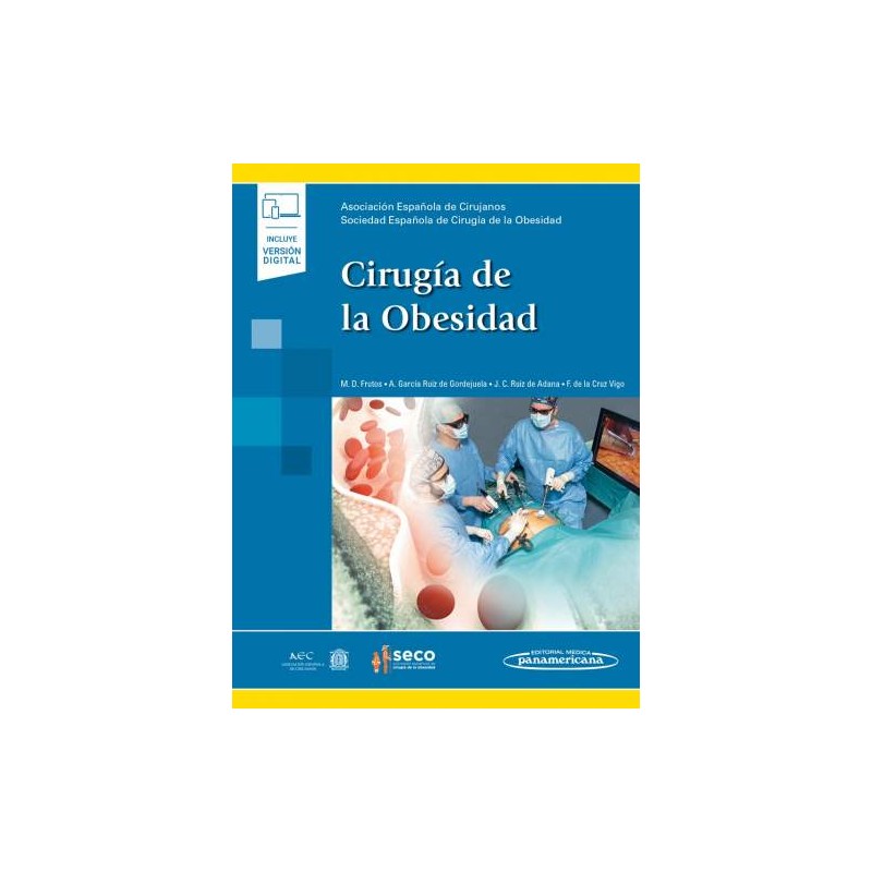 AEC-SECO: Cirugía de la Obesidad 9788491105176