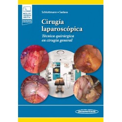 Cirugía laparoscópica Técnica quirúrgica en cirugía general 9789500697071