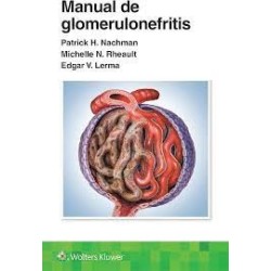 Manual de glomerulonefritis 9788419663160