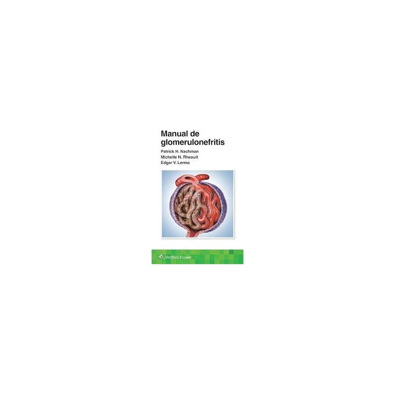 Manual de glomerulonefritis 9788419663160